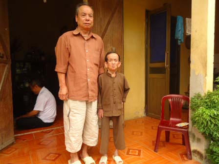 Cụ ông “tí hon” 84 năm mang hình hài con trẻ