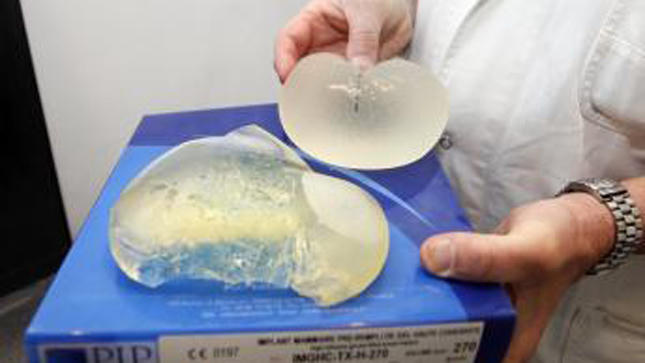 Hơn 5.000 phụ nữ nâng ngực kiện đòi bồi thường