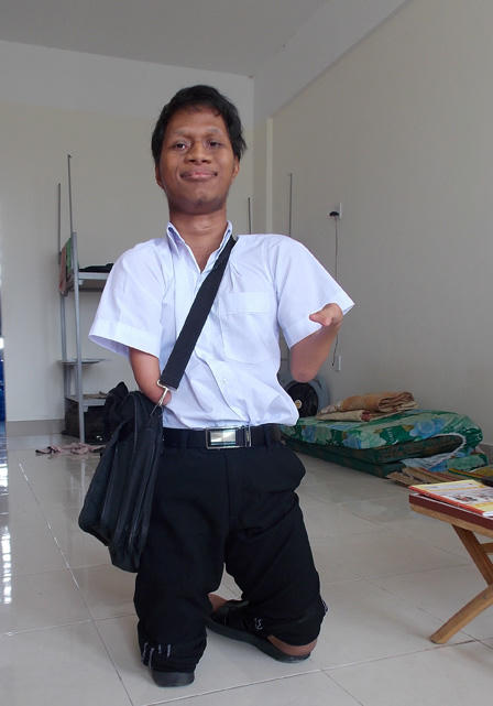 Kỳ tích của cậu bé không tay chân sinh suýt bị chôn sống