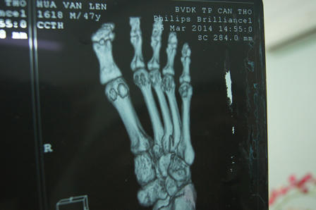 Kết luận giám định “đổi trắng thay đen” làm bỏ lọt tội phạm