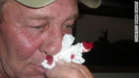 Đòi bồi thường 66 triệu USD vì môi trường có khí độc