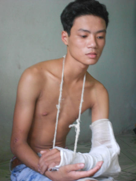 Tiệc sinh nhật bạo lực của cô gái 17