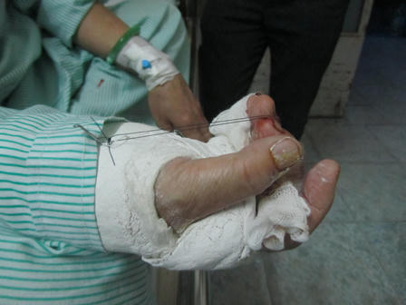 Án mạng của hai người đàn ông “ấm ức trong lòng” vì bà góa?