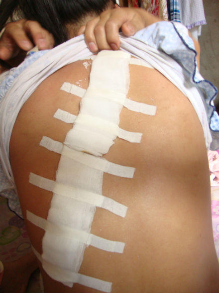 Mẹ nợ tiền, con gái bị chém giữa đường