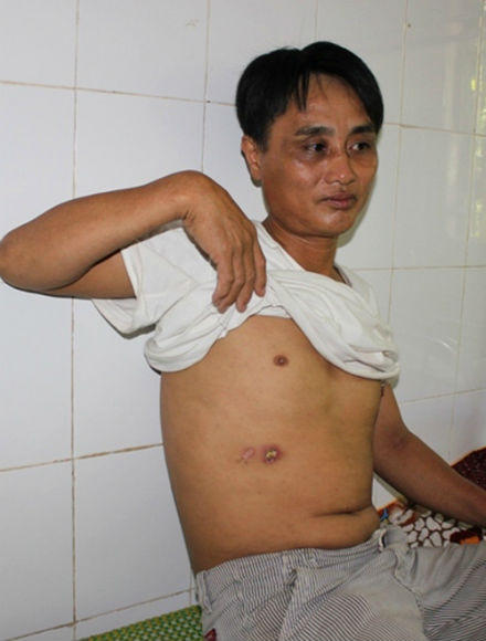 Dùng điện 220V trả thù hàng xóm