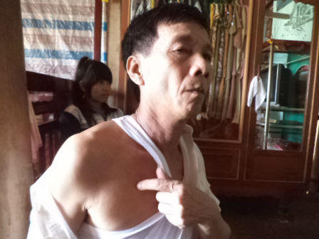 3 công dân Sóc Trăng tố bị công an "ép cung, nhục hình"