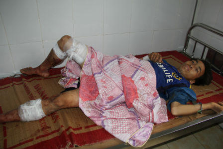 Đêm đấu súng nghẹt thở giữa 68 cảnh sát với 25 tay AK buôn ma túy