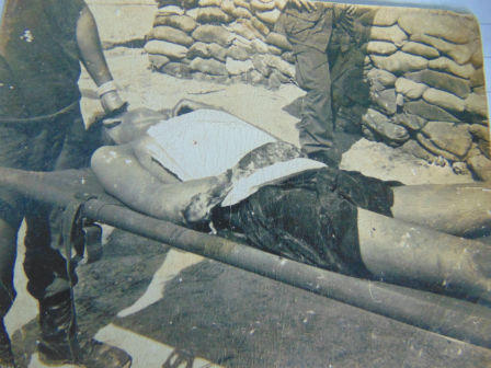 Bất ngờ cuộc trùng phùng với… cánh tay 40 năm lưu lạc