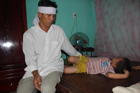 Bữa "tiệc" mì Quảng đoạt mạng cô con dâu xấu số