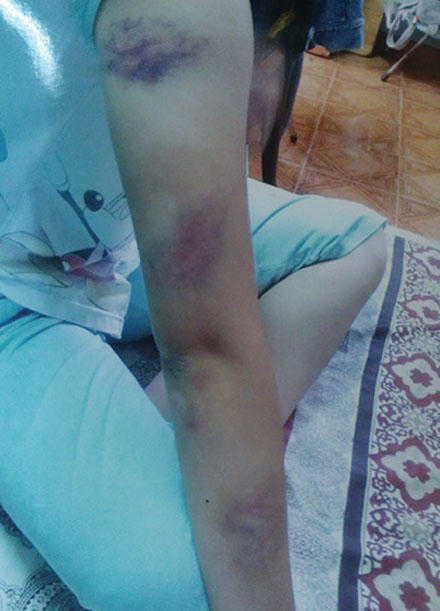 Bị bắt quả tang đang “yêu” thầy trong phòng, nữ sinh trốn nhà đi kết hôn