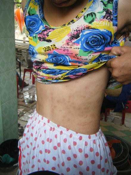 Thiếu nữ tố cáo bị cha mẹ nuôi đánh đập, cưỡng hiếp 6 năm ròng rã