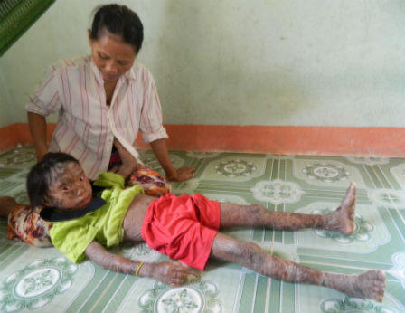 Cô bé khốn khổ: Mỗi tháng một lần thay da