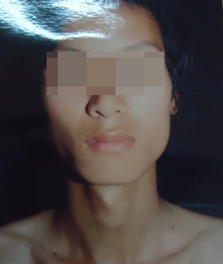 Giết người yêu, lột da mặt nạn nhân hủy nhận dạng (P2)