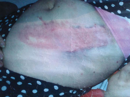 Bị chồng bạo hành vì tội... có bầu