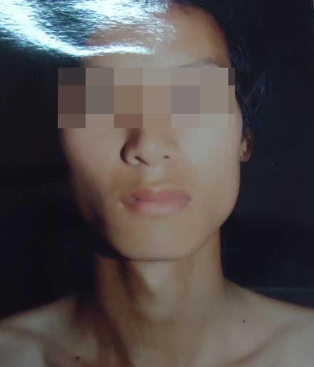 Hố đất định mệnh trong đời kẻ móc mắt, phi tang xác bạn tình