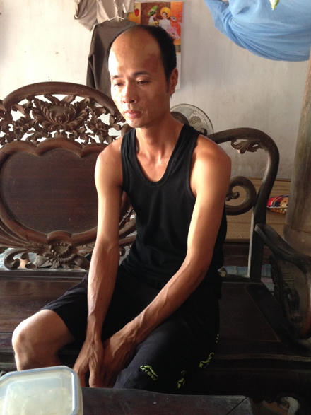 “Gà trống” một mình chăm đàn con bại não, ung thư