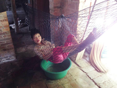 “Gà trống” một mình chăm đàn con bại não, ung thư