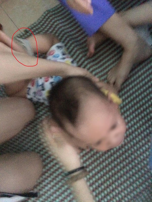 Hãi hùng: 3 cô giáo trói chân tay, nhét giẻ vào miệng bé 14 tháng tuổi