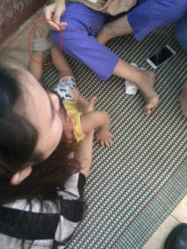 Hãi hùng: 3 cô giáo trói chân tay, nhét giẻ vào miệng bé 14 tháng tuổi