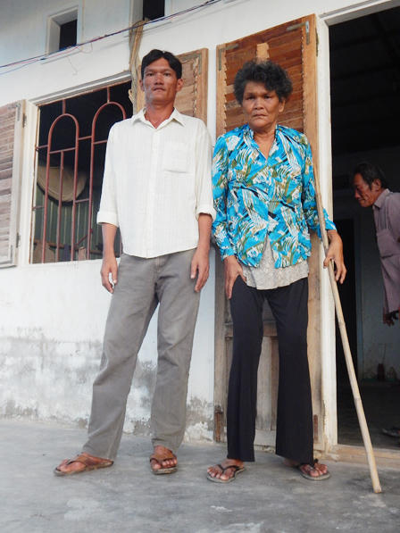 Nghịch lý của gia đình chân dài khốn khổ