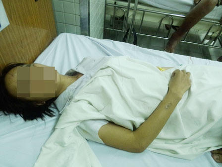 "Quá nóng làm bậy", nam sinh tạt axit huỷ hoại người yêu