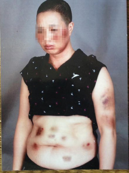 Thiếu phụ nằm chết bên mộ mẹ vì tự vẫn, hay bị bức tử?