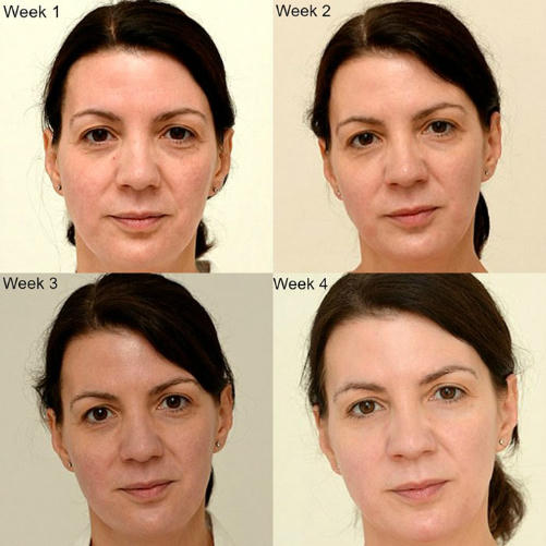 Người phụ nữ 'lột xác' nhờ uống 3 lít nước mỗi ngày