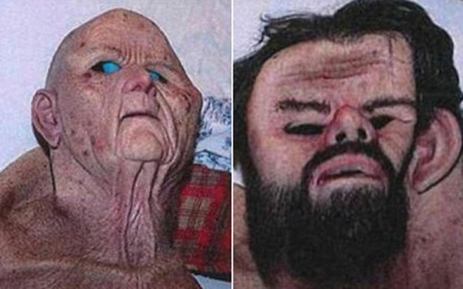 Bác sĩ bệnh hoạn xây hầm, bắt cóc và hãm hiếp phụ nữ