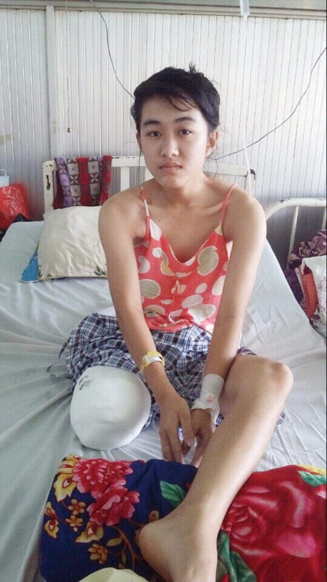 Vào bệnh viện bó bột, nữ sinh bị cưa chân