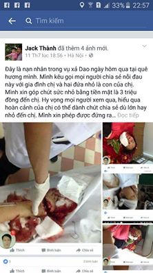 Facebooker quyên góp ủng hộ nạn nhân bị chồng chém vỡ mặt ở Canh Nậu