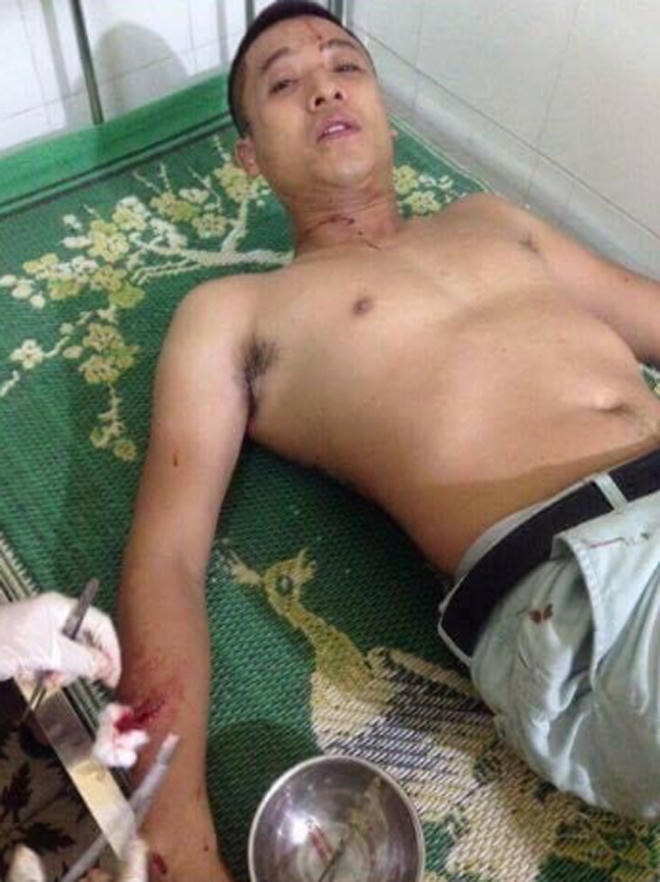 Truy sát trong quán karaoke hai thanh niên bị thương nặng.