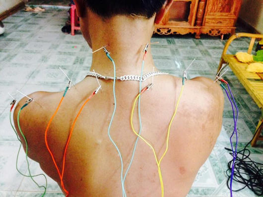 Khắc tinh của bệnh mạn tính