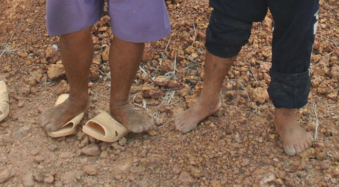 Kỳ lạ cặp đôi “thừa ngón” giống nhau đến cả miếng ăn, giấc ngủ