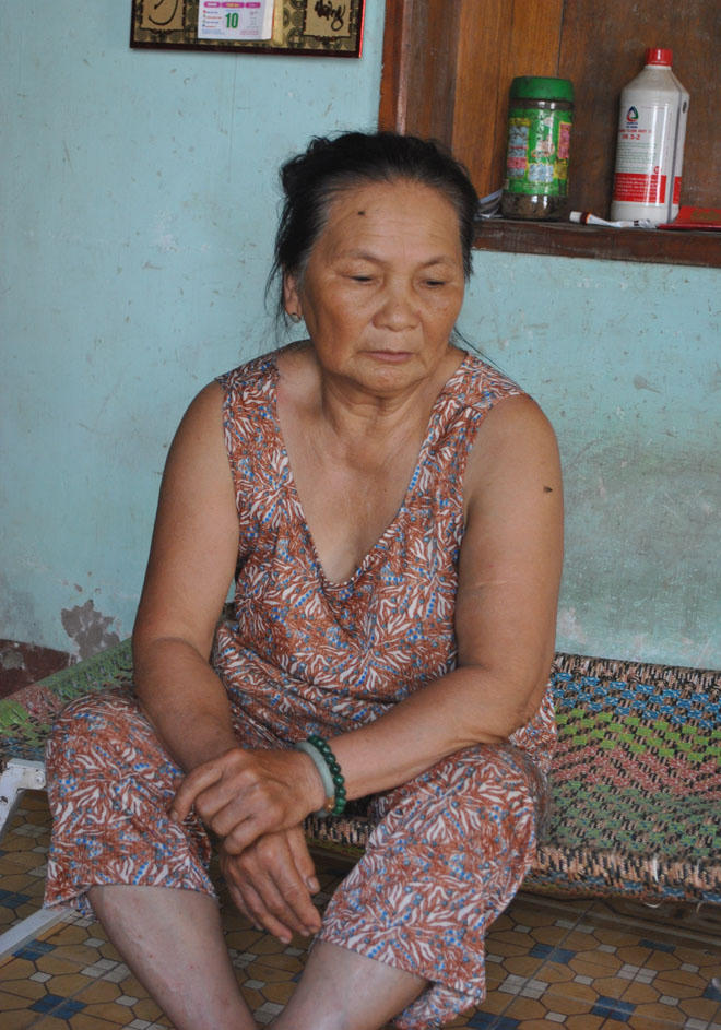 Kỳ lạ cặp đôi “thừa ngón” giống nhau đến cả miếng ăn, giấc ngủ