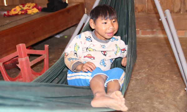 chứng đầu nhỏ, zika, chậm phát triển về trí não, đầu nhỏ bất thường