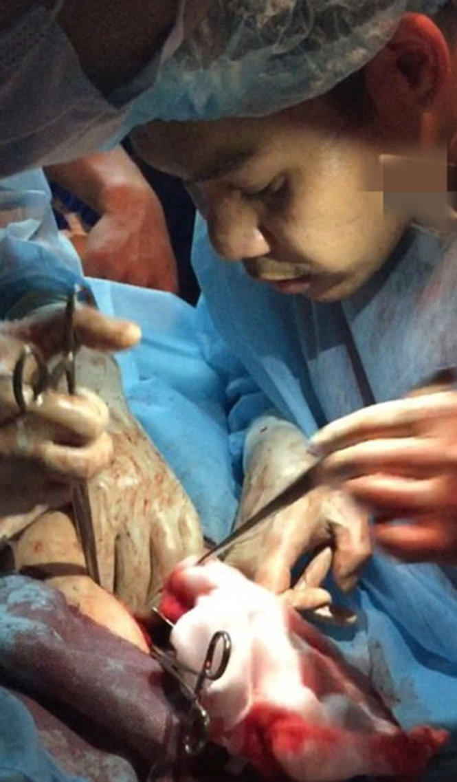 Ly kỳ ca mổ cứu người trên gác xép 