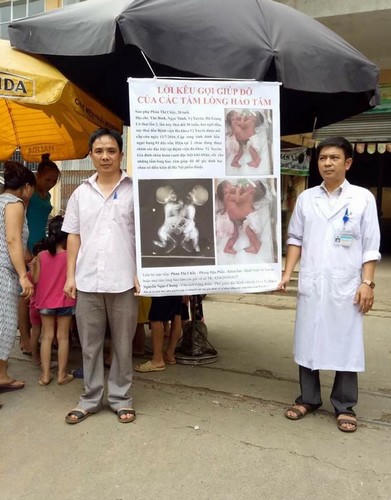 Các bác sĩ Bệnh viện Đa khoa huyện Vị Xuyên Hà Giang ra chợ kêu gọi giúp đỡ cặp song sinh dính liền. Ảnh bệnh viện cung cấp.