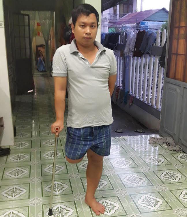 Đề nghị công an khởi tố bác sĩ vụ bệnh nhân bị cưa chân