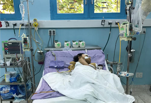 Bé Gia Khiêm trong thời gian hậu phẫu. Ảnh bệnh viện cung cấp.