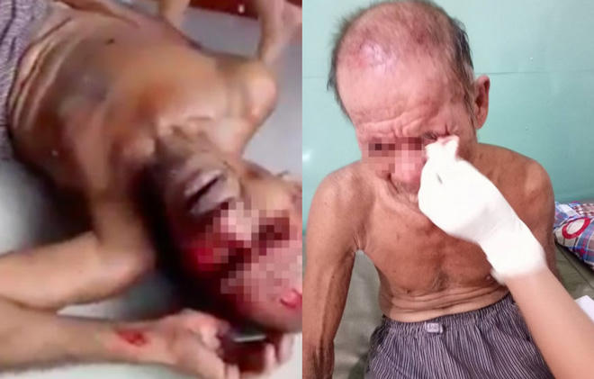 Cụ ông 85 tuổi bị con trai đánh trọng thương  18:05 28/04/2017