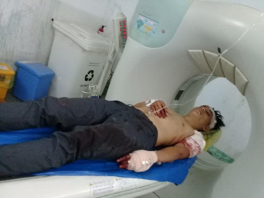  Bệnh nhân H. đang điều trị tại Bệnh viện Đa khoa Trà Vinh trong tình trạng bị thương rất nặng 