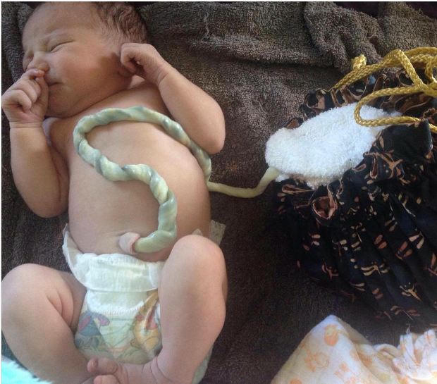 Sinh con không cắt dây rốn: Lợi hay hại?