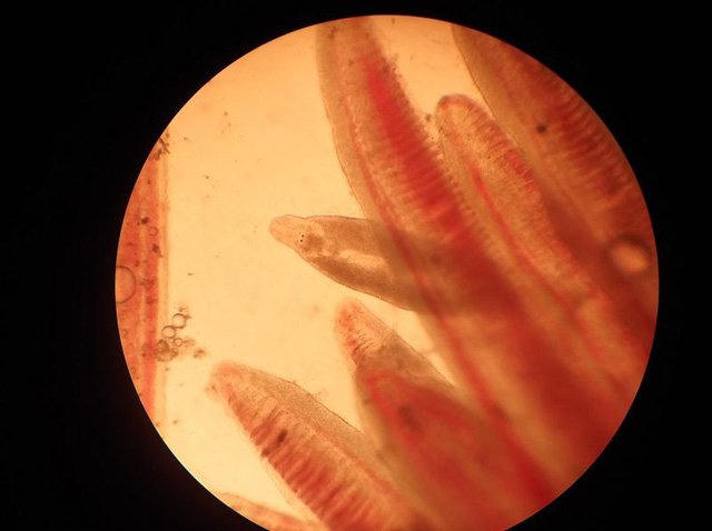 ký sinh trùng, sán lá gan, áp xe gan, giun lươn