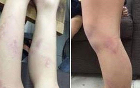 Chu tich Nguyen Duc Chung chi dao lam ro vu co giao danh 11 hoc sinh hinh anh 1