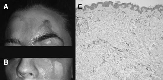 Bệnh lạ: Bỗng nhiên chảy máu cam qua mặt và tay - Ảnh 1.
