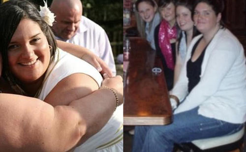 Leanne từng nặng tới 127 kg vì ăn uống mất kiểm soát. Ảnh: The Sun.