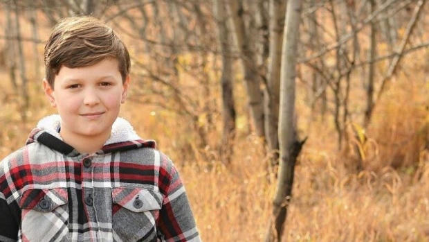 dị ứng,nổi mề đay,bệnh lạ,bệnh hiếm