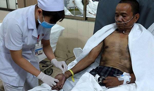 Cấp cứu nạn nhân vụ cháy chung cư bị bỏng hô hấp. Ảnh: Lê Phương.