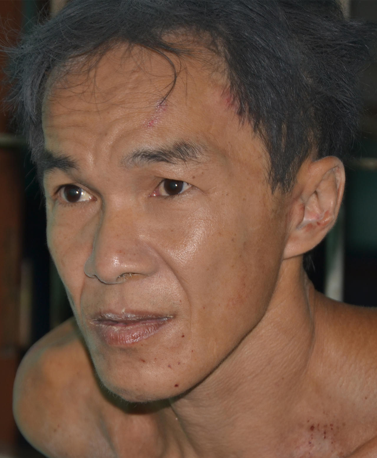 Đồng Tháp:  Khởi tố kẻ chém lìa đầu hàng xóm