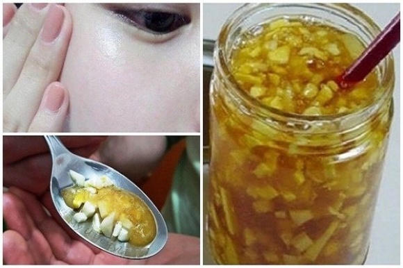 Tỏi ngâm mật ong 4 tỏi ngâm mật ong, tỏi và mật ong, tác dụng của hỗn hợp tỏi ngâm mật ong